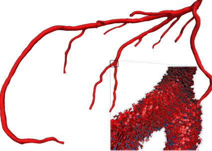 Image: The left coronary arteries, showing the ramification of blood vessels and RBC flow in one subregion (photo courtesy Ecole Polytechnique Fédérale de Lausanne).